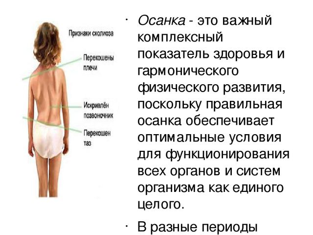 Презентация "Осанка. Профилактика заболеваний"