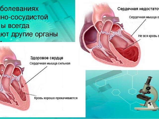 Презентация по ознакомлению с миром природы.Тема: Строение человека. Сердечно-сосудистая система.