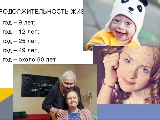 Презентация по логопедии на тему: "Оказание логопедической помощи ребенку с синдромом Дауна"