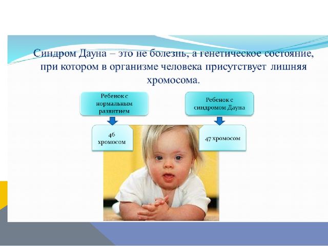 Презентация по логопедии на тему: "Оказание логопедической помощи ребенку с синдромом Дауна"