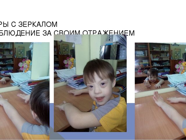 Презентация по логопедии на тему: "Оказание логопедической помощи ребенку с синдромом Дауна"