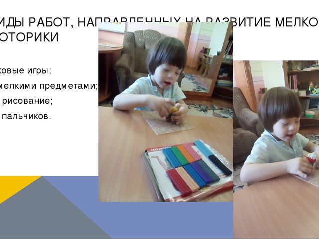 Презентация по логопедии на тему: "Оказание логопедической помощи ребенку с синдромом Дауна"