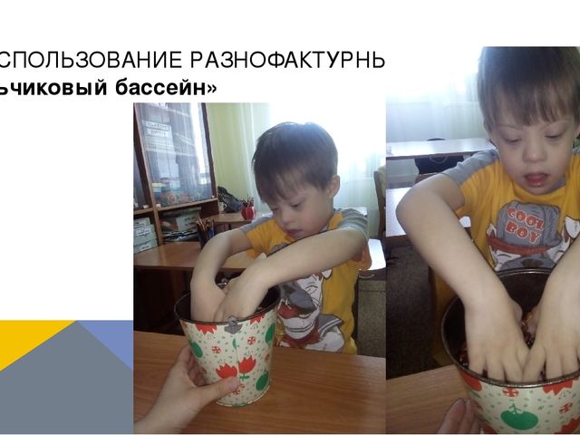 Презентация по логопедии на тему: "Оказание логопедической помощи ребенку с синдромом Дауна"
