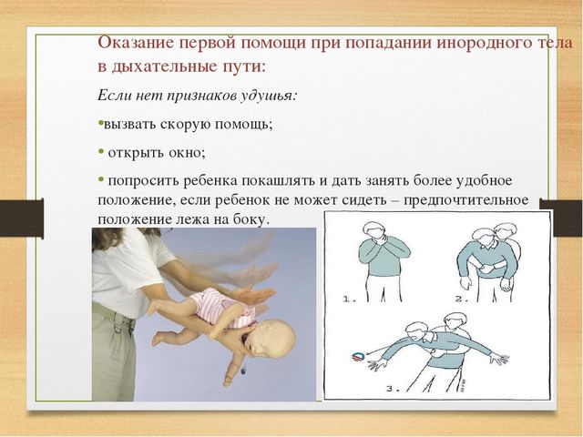 Оказание первой доврачебной помощи детям