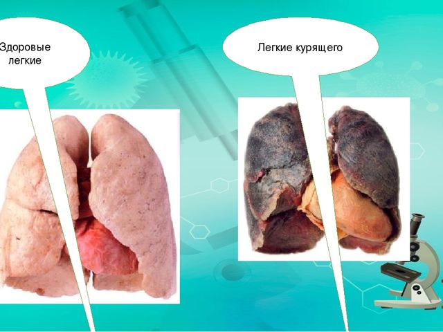 Презентация по ознакомлению с миром природы.Тема: Строение человека. дыхательная система.