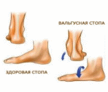Shape3