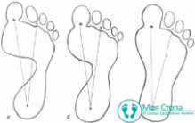 Shape6