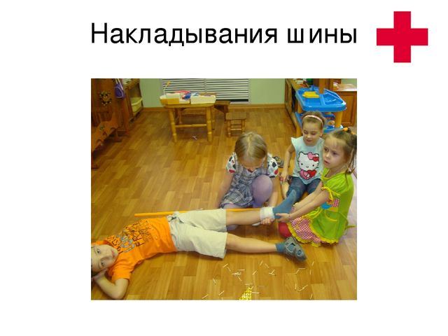 Презентация "Спички детям не игрушка"