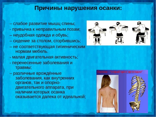 Осанка залог здоровья подготовительная группа