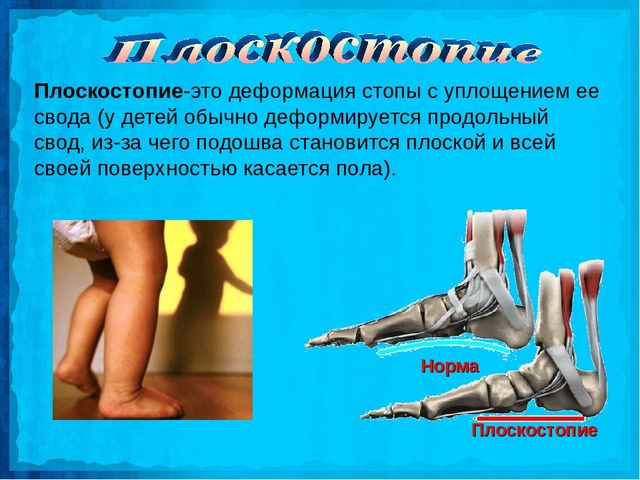 Осанка залог здоровья подготовительная группа